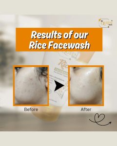 Home rice facewash | brightening cleanser with niacinamide & glutathione for all skin types (100g)